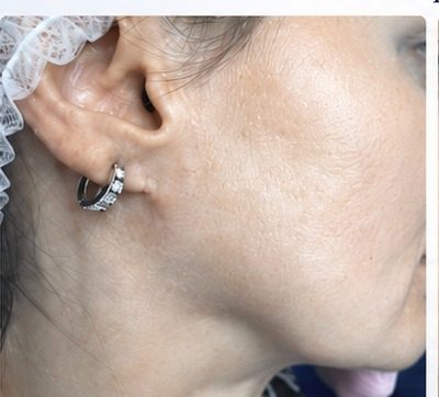 Caz clinic 01 — după, imagine 1